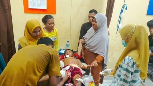 Korban bom ikan dirawat di Puskesmas Wera. (Dok. Polsek Wera)