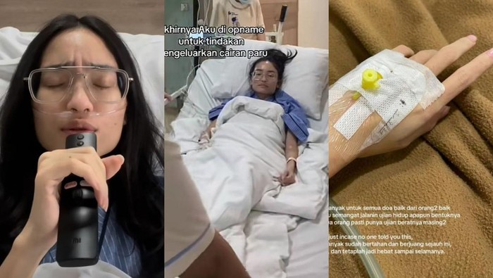 Wanita Jakbar Kena Kanker Paru Awalnya Keluhkan Flu, Dokter Bilang Gini