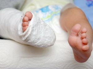 Balita Tewas dengan Tubuh Luka Bakar Diduga Dianiaya Ibu Tiri