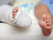 Balita Tewas dengan Tubuh Luka Bakar Diduga Dianiaya Ibu Tiri