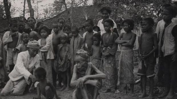 Arsip foto kondisi masyarakat Cirebon saat gizi buruk zaman Hindia Belanda.