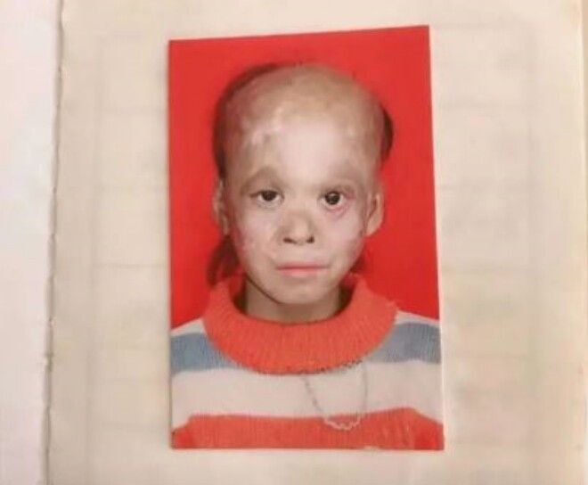 Ly Hoa Mai dan Tieu Duong