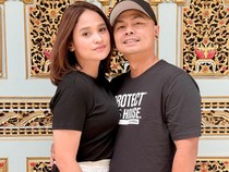 Kondisi Wendi Cagur Sudah Membaik Usai Sempat Dilarikan ke RS saat Syuting