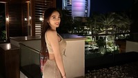 Angel Karamoy dipuji makin awet muda setelah operasi hidung. (Foto: dok Instagram)