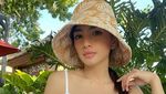 Tampilan Muda Angel Karamoy Usai Operasi Hidung