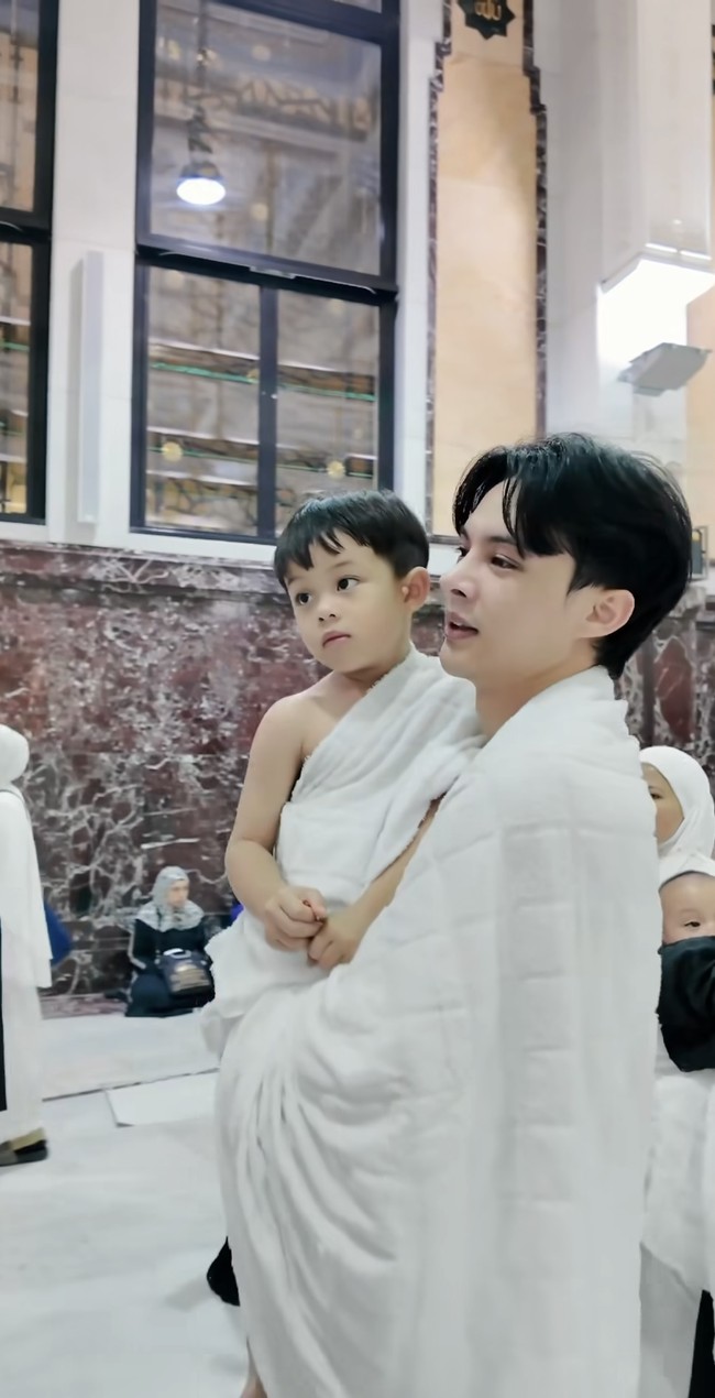 Rey juga mengaku tak berniat untuk membuat hidungnya jadi terlihat lebih mancung. Ia hanya ingin meluruskan dan melegakan pernafasannya. Foto: Instagram/@rey_mbayang