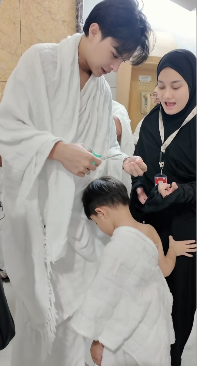 Setelah menjalani operasi plastik pada hidungnya, kini hidung Rey terlihat semakin mancung. Foto: Instagram/@rey_mbayang