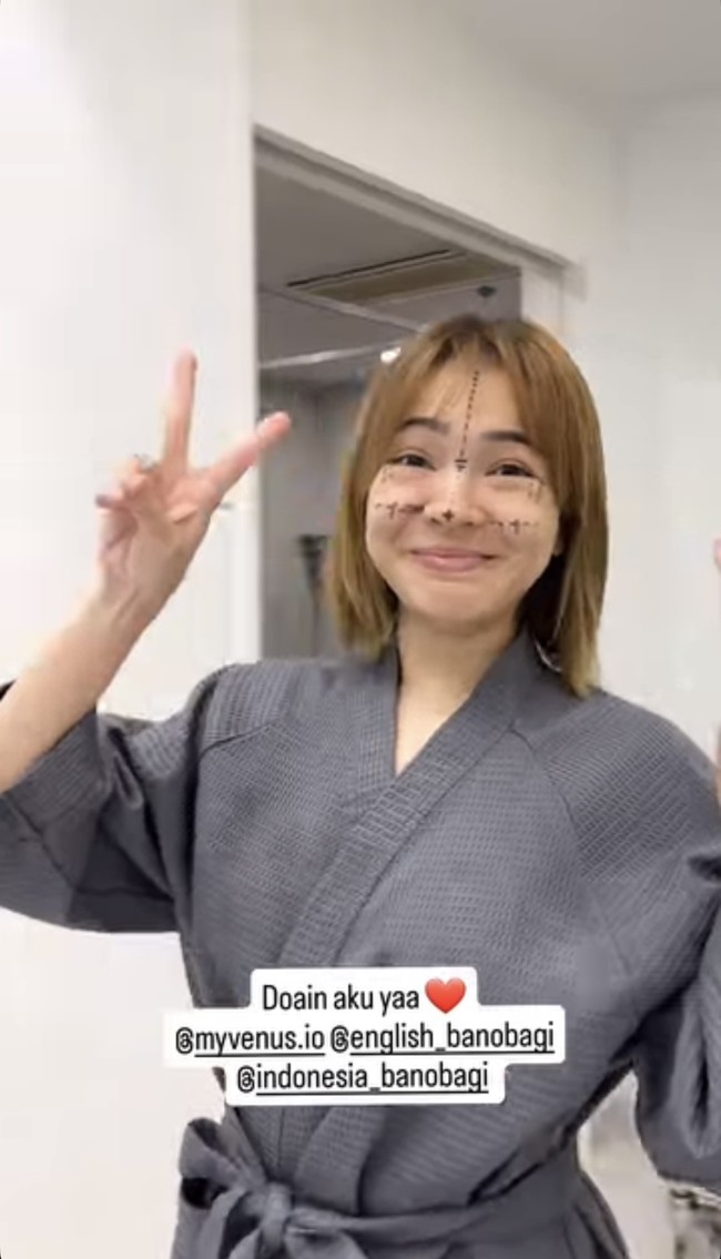 Maya mengungkapkan alasannya akhirnya memilih untuk menjalani operasi plastik ialah untuk membuat bagian wajahnya menjadi lebih simetris. Maya merasa jika hidung hingga bagian rahangnya tersebut miring. Foto: Instagram/@mayaseptha7