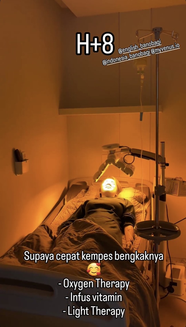 Untuk mengurangi bengkak dan mempercepat penyembuhan pada wajahnya, Maya menjalani berbagai treatment pasca oplas di klinik yang sama. Foto: Instagram/@mayaseptha7