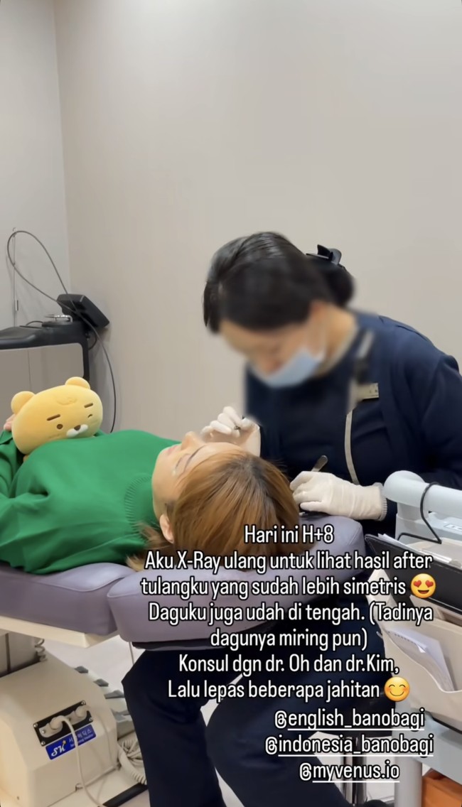 Hari ke-8 setelah operasi Maya kembali menjalani X-ray untuk melihat hasilnya. Maya mengatakan jika wajahnya sudah lebih simetris. Dagunya sudah berada tepat di tengah. Selain itu ia juga melepas beberapa jahitan oplasnya. Foto: Instagram/@mayaseptha7