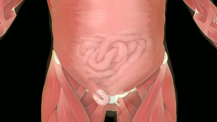 4 Cara Mengobati Turun Berok Pria, Apakah Berbahaya?