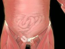 4 Cara Mengobati Turun Berok Pria, Apakah Berbahaya?