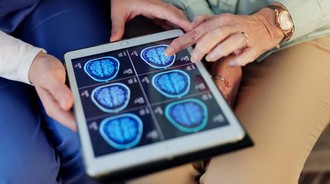 Neurolog: Jangan Remehkan Sakit Kepala Seperti Ini, Bisa Jadi Pertanda Tumor Otak