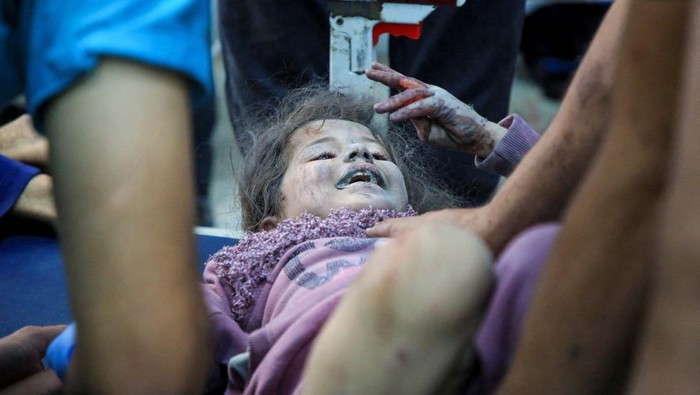 A Palestinian child wounded in an Israeli strike receives treatment at Al-Ahli hospital, amid the ongoing Israel-Hamas conflict, in Gaza City, October 26, 2024. REUTERS/Mahmoud Sameer      TPX IMAGES OF THE DAY
