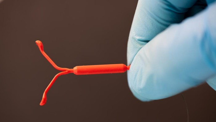 Benarkah Alat KB IUD Hormonal Memicu Kanker Payudara? Ini Kata Ahli