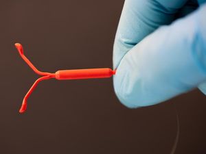 Benarkah Alat KB IUD Hormonal Memicu Kanker Payudara? Ini Kata Ahli