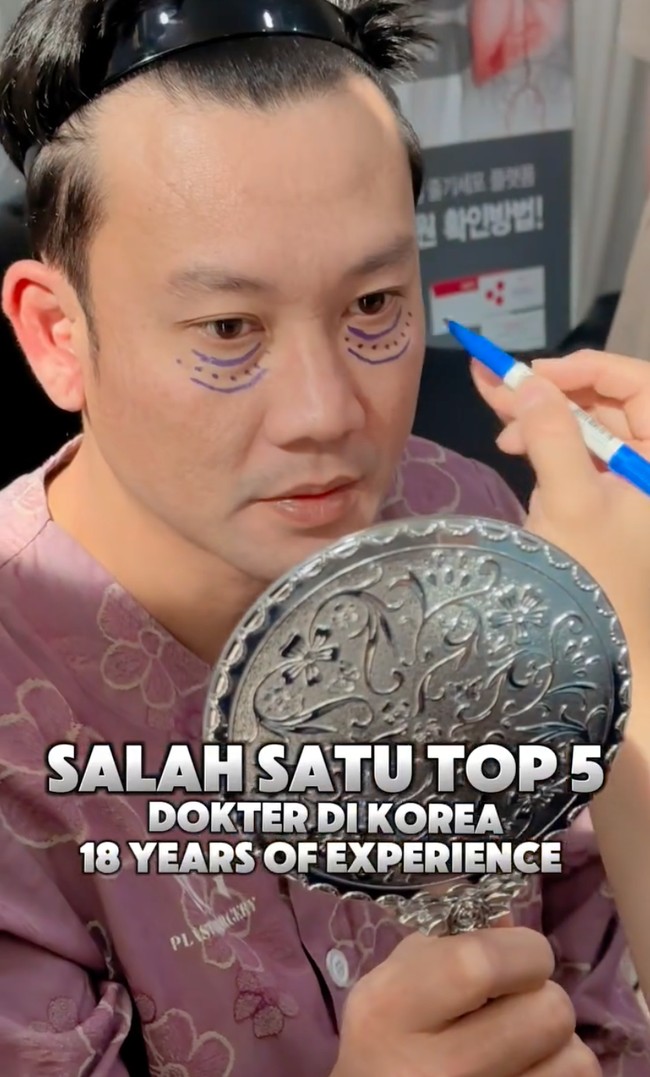 Untuk operasi kantung matanya Densu ditangani oleh dokter Im, salah satu dokter terbaik di bidangnya. Terlihat bagian bawah mata Densu ditandai terlebih dahulu sebelum tindakan. Foto: Instagram/@sumargodenny