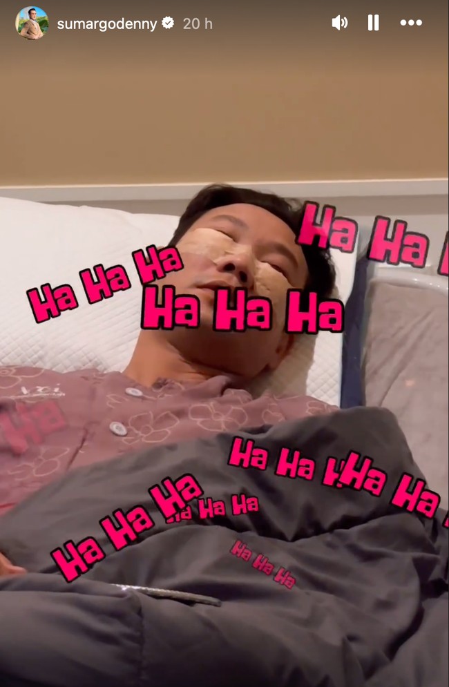 Setelah operasi bagian mata Densu terlihat bengkak. Daerah kantung matanya juga tampak diperban. Foto: Instagram/@sumargodenny