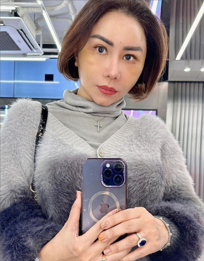 Ini dia penampakan wajah terbaru Femmy, 10 hari setelah operasi plastik. Foto: Instagram/@femmypermatasari