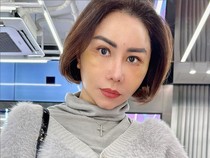 Femmy Permatasari Rogoh Rp 700 Juta, Ini Rangkaian Oplasnya di Korea