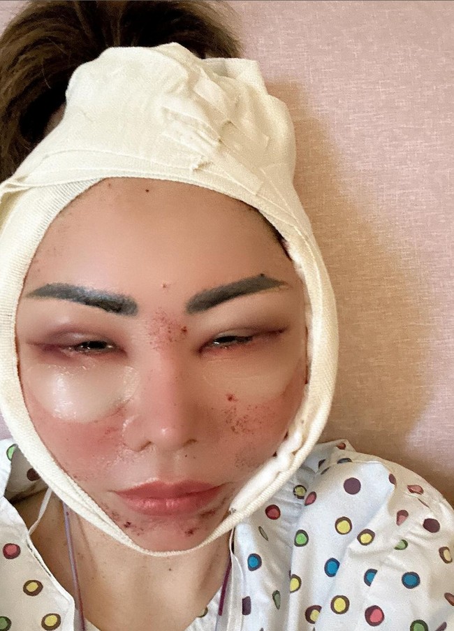 Aktris 50 tahun ini memilih klinik operasi plastik di Korea Selatan yang sudah teruji kredibilitasnya. Sebab dia akan menjalani enam prosedur kecantikan sekaligus. Foto: Instagram/@femmypermatasari