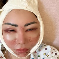 Aktris 50 tahun ini memilih klinik operasi plastik di Korea Selatan yang sudah teruji kredibilitasnya. Sebab dia akan menjalani enam prosedur kecantikan sekaligus. Foto: Instagram/@femmypermatasari