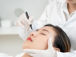 Buccal Fat Removal, Tren Kecantikan untuk Miliki Wajah Tirus Tanpa Diet