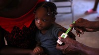 UNICEF turun tangan untuk menangani gizi buruk di Haiti.  