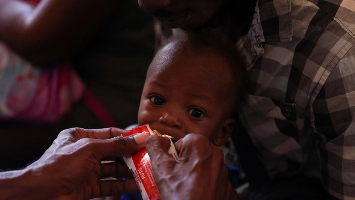 A child's arm is measured to check for malnutrition at a mobile health clinic organized by UNICEF and Medecins du Monde for people displaced by gang violence, in Port-au-Prince, Haiti October 31, 2024. REUTERS/Ralph Tedy Erol