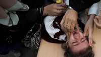 WHO menyebut bahwa anak di bawah 10 tahun perlu mendapat dua dosis vaksin untuk menghentikan penularan virus polio.