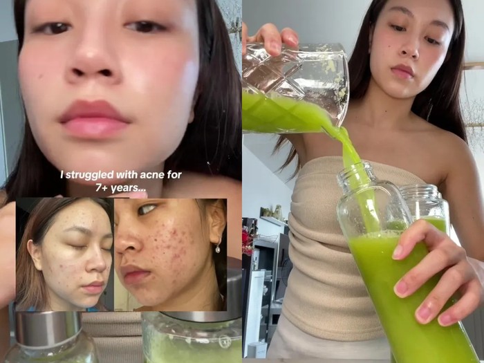 jus seledri, nanas, dan jahe yang bisa  sembuhkan jerawat