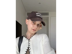 Bintang TikTok Umumkan Kematiannya dalam Video Terakhir Setelah Melawan Kanker