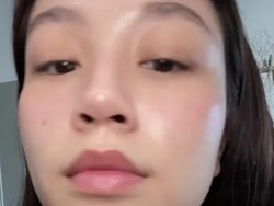 Kisah Wanita yang Glow Up karena Rutin Minum Jus, Sebelumnya Jerawatan 7 Tahun