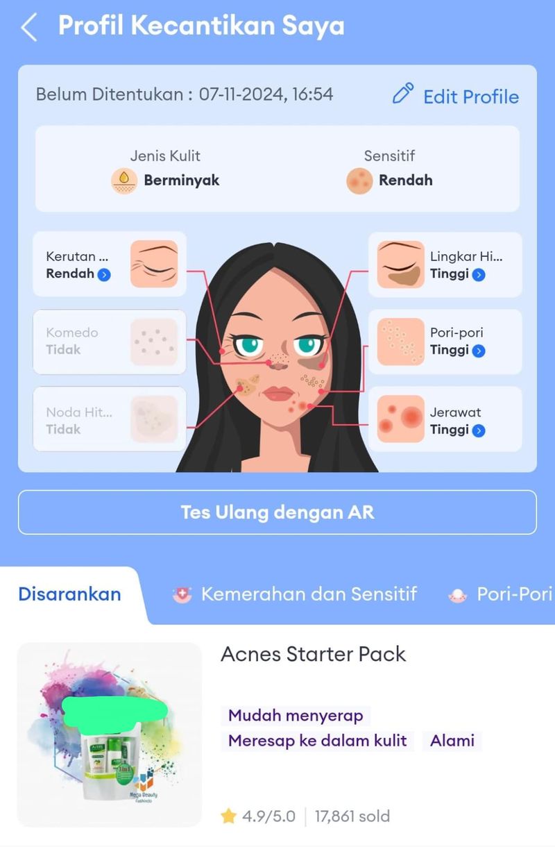 Skin test Lazada.
