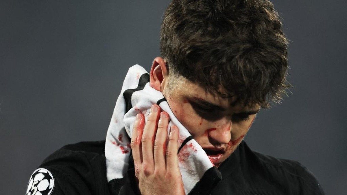Pau Cubarsi berdarah di laga Red Star vs Barcelona. (Foto: AFP/PEDJA MILOSAVLJEVIC)