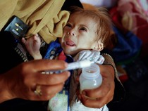 Derita Balita di RS Nasser Khan Younis Gaza