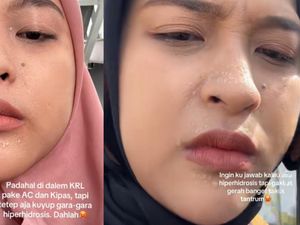Penyebab Hiperhidrosis, Dikaitkan Viral Wanita Curhat Sering Banjir Keringat