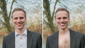 Ingin gigi tampak lebih putih... Foto: James Fridman via Boredpanda