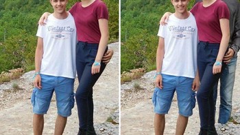 Ingin tangan dihilangkan...Foto: James Fridman via Boredpanda