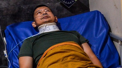 Begini Kondisi Korban Luka Kecelakaan Beruntun di Tol Cipularang