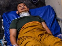 Begini Kondisi Korban Luka Kecelakaan Beruntun di Tol Cipularang