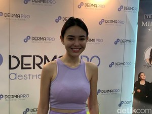Amanda Manopo Ogah Oplas, Masih Sayang Duit