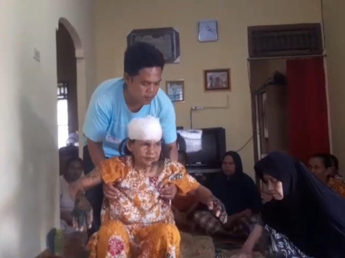 Kondisi Hasna (55) terbaring lemas di rumah jalani pemulihan
