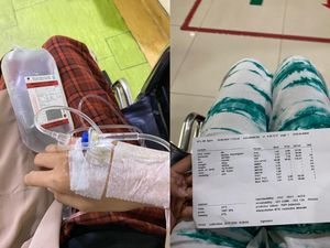 Wanita Jaktim Kena Pneumonia Dikira Masuk Angin Biasa, Ini Gejala yang Dikeluhkan