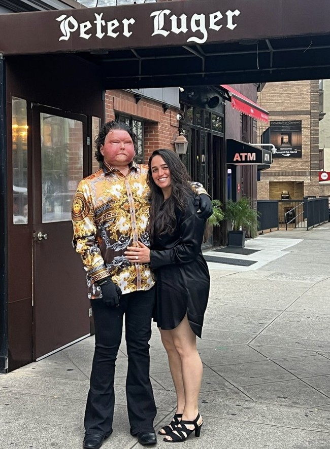 Pria asal New Jersey itu mengalami kecelakaan mobil dan mobilnya meledak hingga 80 persen tubuhnyaa terbakar parah. Foto: dok. Instagram @jessicakoby