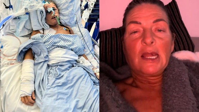 Wanita Ini Idap Kanker di Lidah, Awalnya Dikira Cuma Luka karena Tergigit