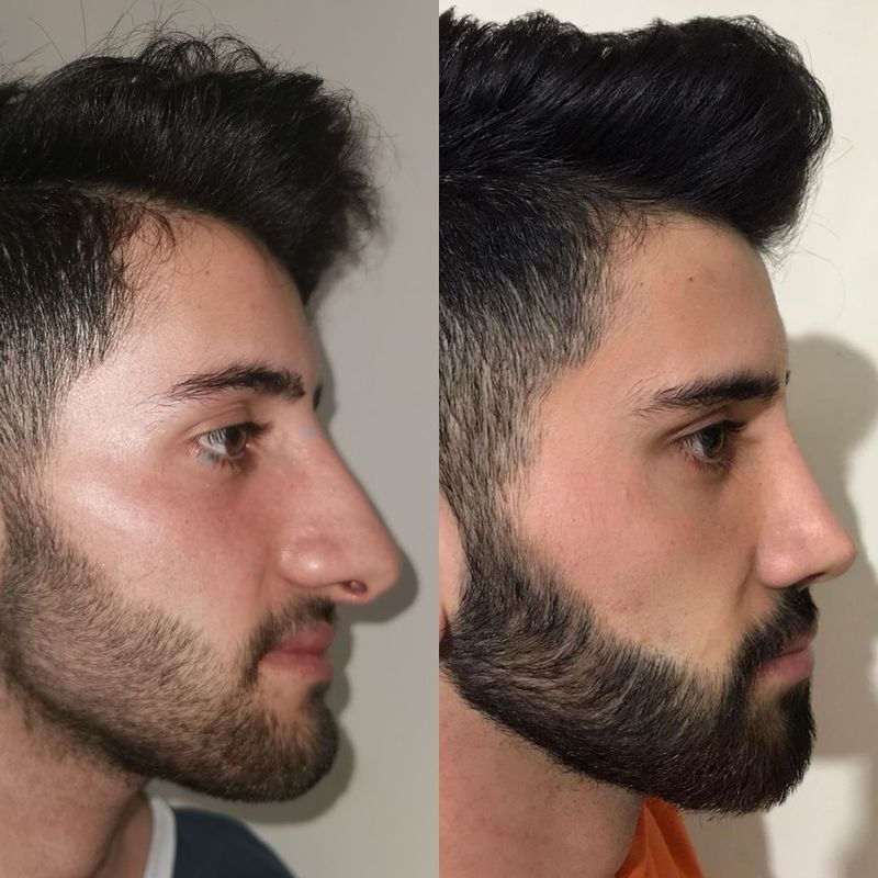 Transformasi pria operasi plastik jadi seperti beda orang.