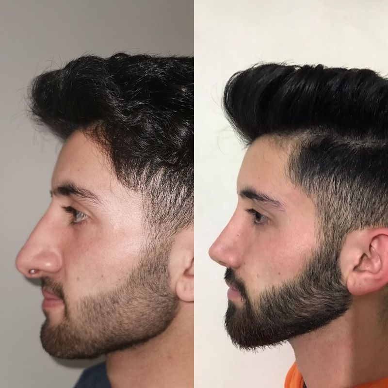 Transformasi pria operasi plastik jadi seperti beda orang.