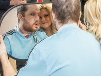 Foto Pria yang Jalani Transplantasi Wajah, Begini Penampilan Terbarunya