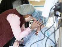 Pria AS Jalani Transplantasi Wajah, Mukanya Hancur usai Percobaan Bunuh Diri